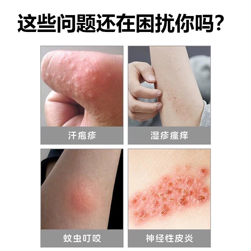 陈九玄医用聚乙二醇护创敷料｜湿疹皮炎屏障修复凝胶怎么选？真有用吗？-医用乳膏器械-淘宝百科网