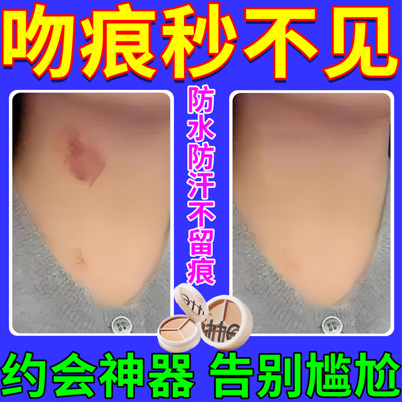 Scar Cover-Up for Kissing Marks, Strawberry Marks, Neck Birthmarks, Tattoo Concealment, Invisible Patch, Special Scar Concealer Scar Cover-Up for Kissing Marks, Strawberry Marks, Neck Birthmarks, Tattoo Concealment, Invisible Patch, Special Scar Concealer