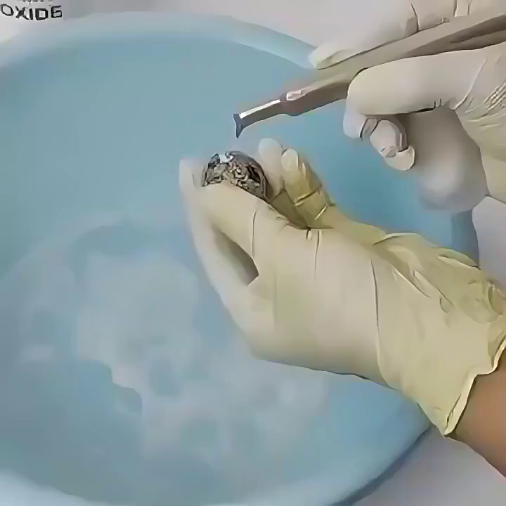 牙科喷砂枪怎么用牙科喷砂枪防回吸设计真不是玄学，3秒断流保护患者更安心✨_https://www.jmylbn.com_新闻资讯_第1张