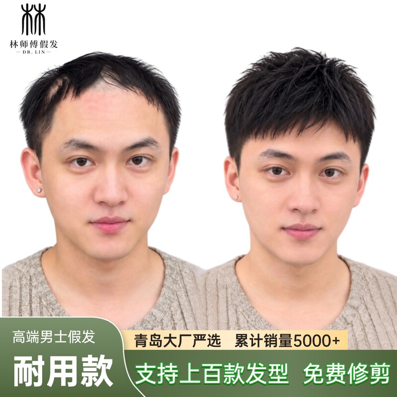 Needle-Injection Artificial Scalp Men's Wig, Real Hair, Qingdao Invisible, Realistic, Durable, No Hair Loss, Natural Color, Not Black Needle-Injection Artificial Scalp Men's Wig, Real Hair, Qingdao Invisible, Realistic, Durable, No Hair Loss, Natural Color, Not Black