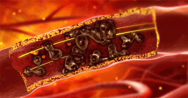 20260720_170504_061.gif