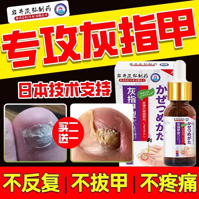Japanese Special-Effect Genuine Nail Fungus Cream Antibacterial Liquid Imported Nail Removal Essential Oil One-Drop Solution for Nail Fungus Treatment, Special Nail Cream for Paronychia, Nail Fungus Removal, Pus Reduction, Swelling Reduction, Toenail Ingrown Toenail Treatment