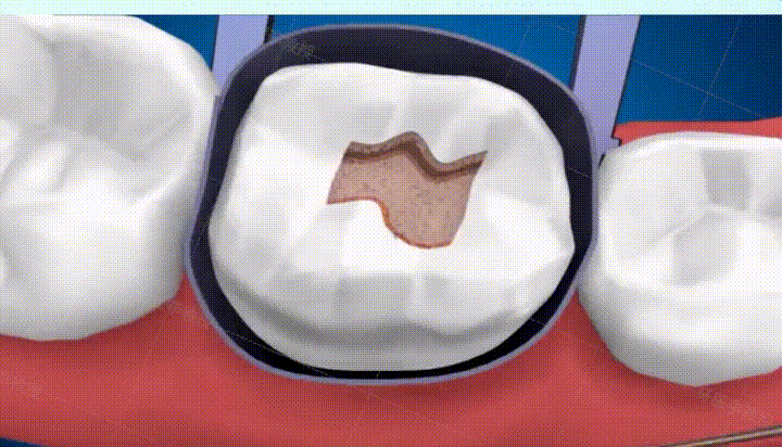 详情14.gif