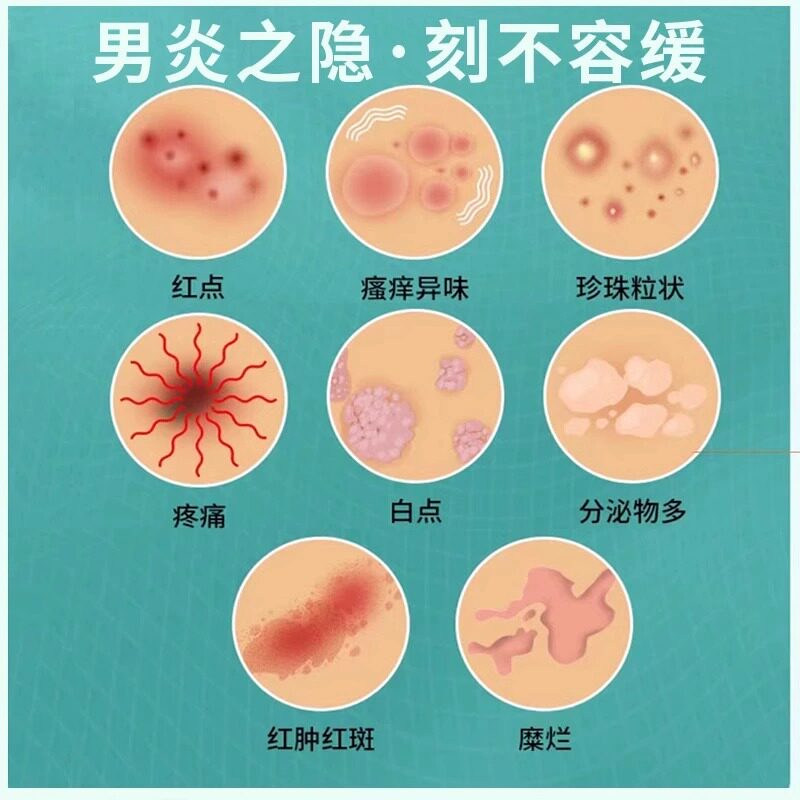 龟头包皮炎症开裂口发炎真菌感染红肿白垢破裂开龟头炎男科药膏FF，原价15.50性价比炸裂！_游戏皮肤_淘宝游戏网