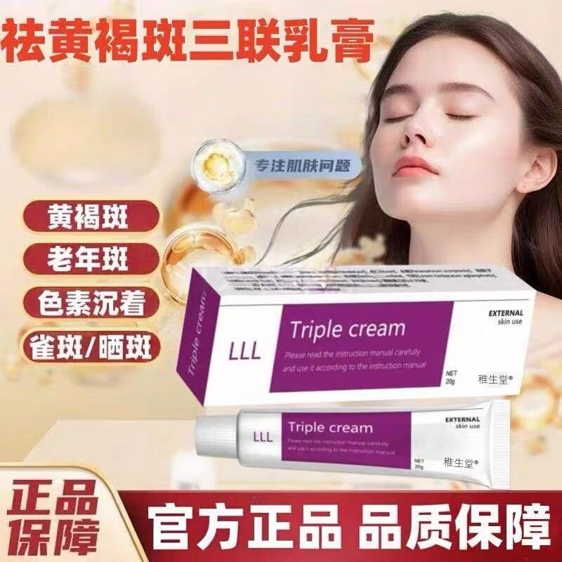 Chloasma Triple Cream Kligman Triple Cream Kligman Melanin Deposition and Lightening Cream Triple Cream