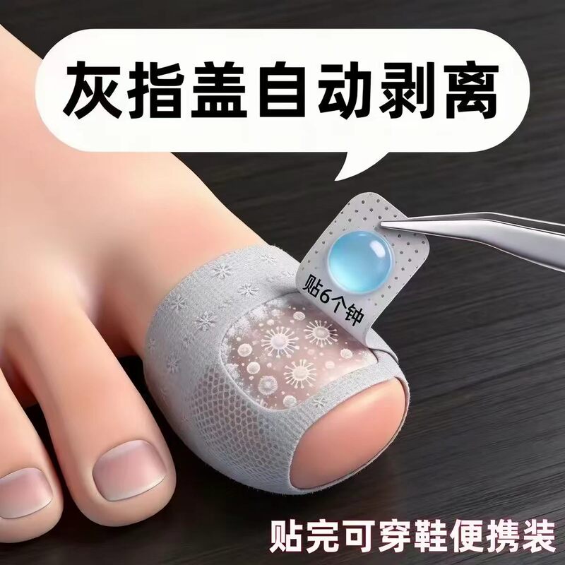 [Hot-Selling Chinese Medicine Product] Herbal Plant Extract Nail Stickers, Genuine Product, Specially Designed for Damaged Hands and Toes, Suitable for Both Men and Women