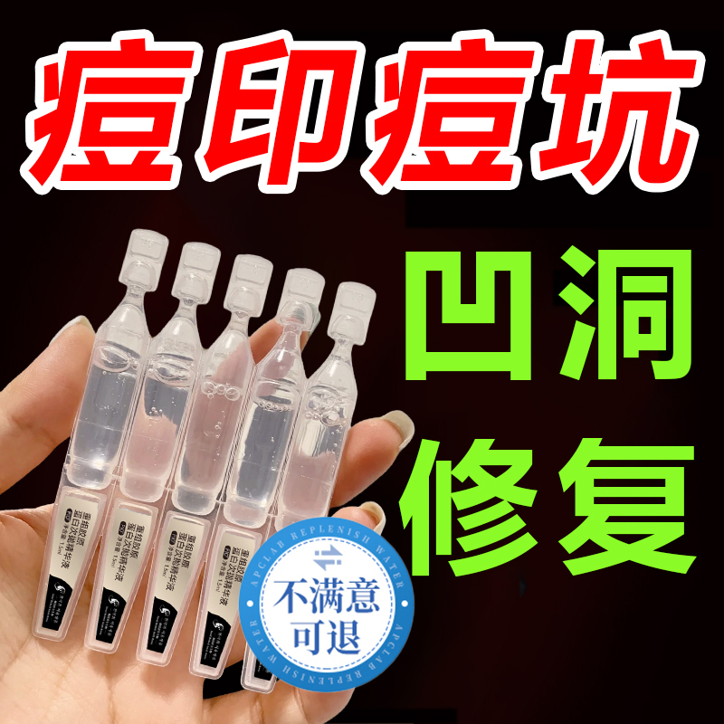 Acne Scar and Pit Repair Growth Factor Essence to Fill and Smooth Artificial Skin Marks, Repair Large Pores, Single-Use