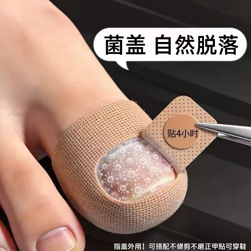 【Hot-Selling Chinese Medicine Product】Specialized Nail Patch for Removing Fungus, Plant Extract, Genuine Product, Suitable for Both Toenails and Fingernails 【Hot-Selling Chinese Medicine Product】Specialized Nail Patch for Removing Fungus, Plant Extract, Genuine Product, Suitable for Both Toenails and Fingernails