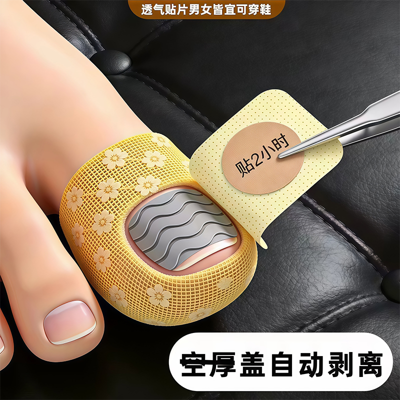 【Hot-Selling Chinese Medicine Product】Specialized Nail Patch for Removing Fungus, Plant Extract, Genuine Product, Suitable for Both Toenails and Fingernails