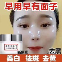 Anti-age spot artifact removes melanin and fades sunburn on the back of the hand face cream for the elderly special freckle cream