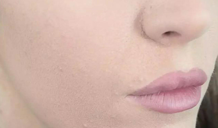 �ҿ�����������ɴ������֢��ҩ������Ч ͼ5
