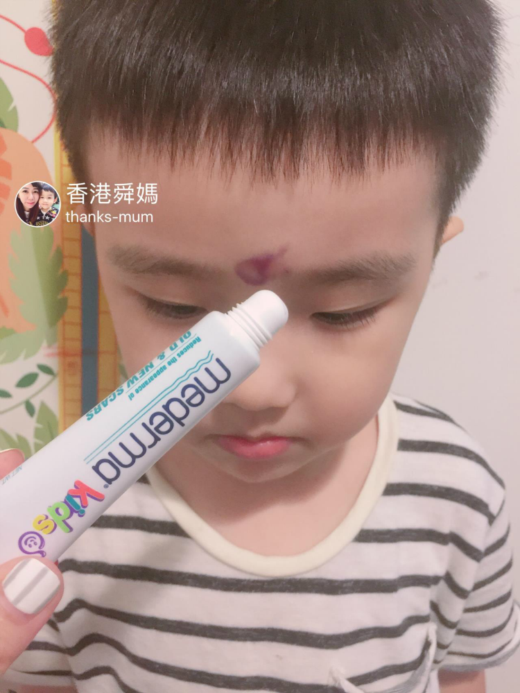 Hong Kong's Shunma Germany's Mederma baby baby scarred with burn scars to moisturize the skin