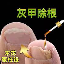 Tong Ren Tang hot sale 100000 non-guaranteed no repair (one drop) painlessly removes bad potassium from hands and toes without damaging good potassium