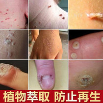 15 (48569 buyers)Say goodbye to skin interference