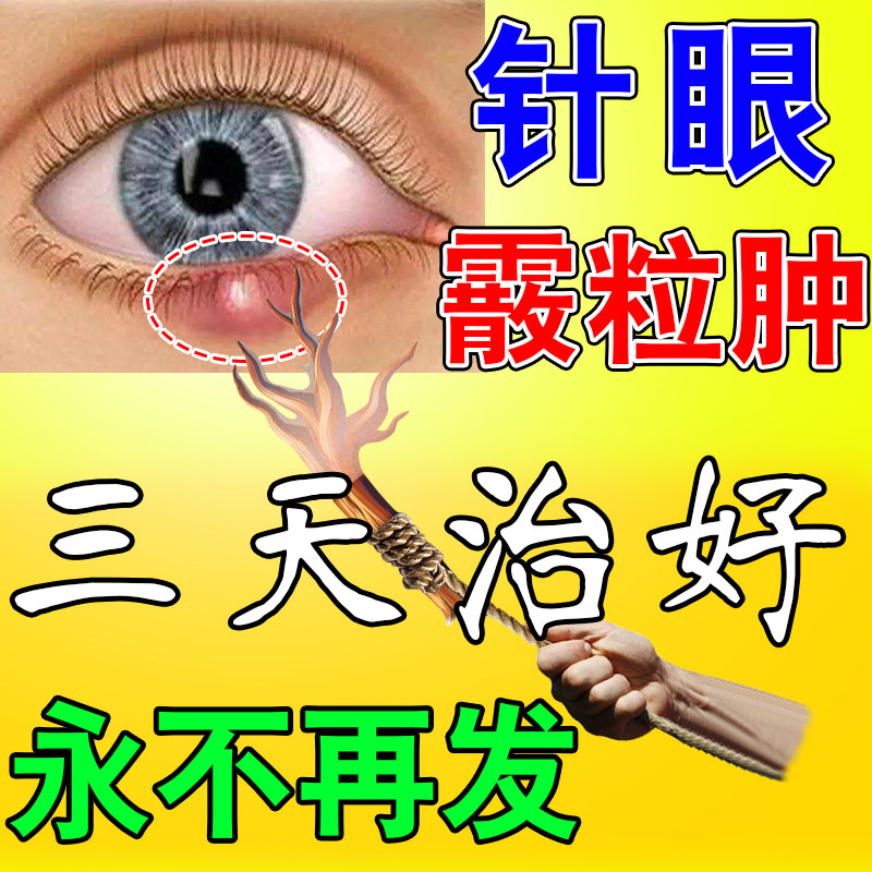 Chalazion hot compress eye patch children's stye meibomian gland dredging blockage massage to remove loose grain swollen eye drops