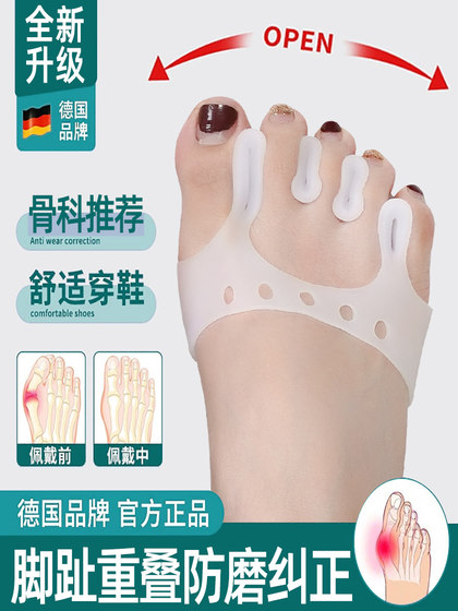 어린이, 성인 남성 및 여성 작은 발가락 발가락 스플리터 패드를위한 큰 암컷 발가락 엄지 valgus 보정 도구를위한 특수 보정 장치