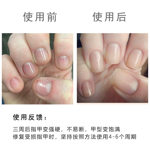 OPI, гель-лак, лечебное питательное масло для ногтей, новая версия