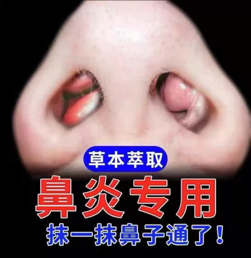 Pepgrass Traditional Chinese medicine earthwork rhinitis paste sinusitis nasal sinusitis anti-allergic goose uncannibalsamic pasta spray for external use