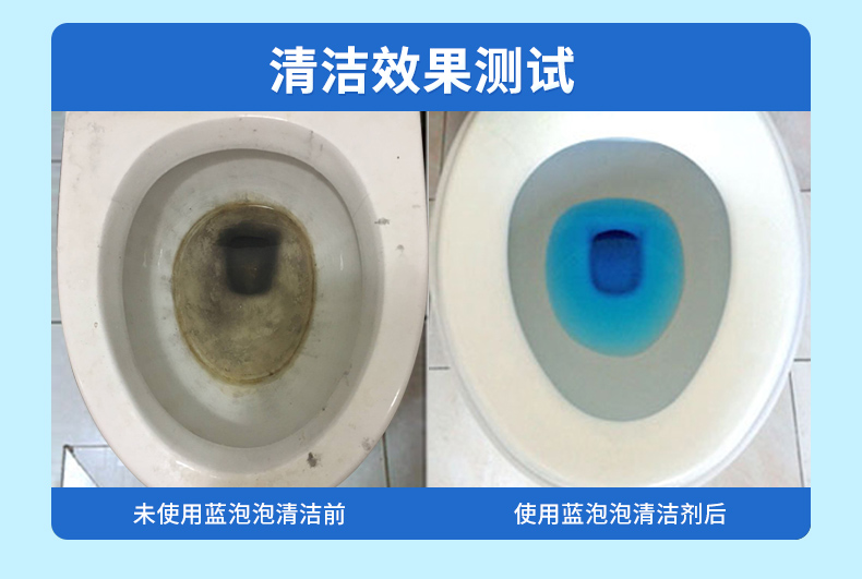 Màu xanh bong bóng nhà vệ sinh nhà vệ sinh nhà vệ sinh nhà vệ sinh nhà vệ sinh nhà vệ sinh - Trang chủ tẩy trắng nắp nhựa bồn cầu