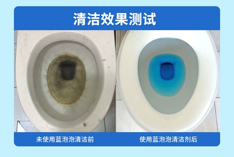 Màu xanh bong bóng nhà vệ sinh nhà vệ sinh nhà vệ sinh nhà vệ sinh nhà vệ sinh nhà vệ sinh - Trang chủ nước tẩy vết ố nhà vệ sinh