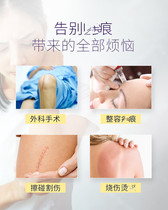 German original imported gel desalination stretch marks pigmented scar surgery scar smooth repair sunken skin 50g