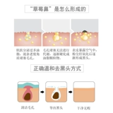 Жидкость для экспорта черных точек, закрытая вода от прыщей, удаление черных точек, сужение пор, специальная корейская линия для салонов красоты с маленькими пузырьками