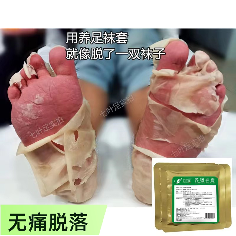 七叶足光粉泡脚药包强力款除臭去死皮干裂脱皮出汗异味清新控味