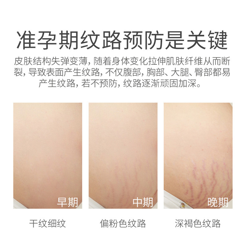 澳兰黛橄榄油备孕舒纹妇女护肤专用妊娠油护理身体油敏防淡化纹路 — 6