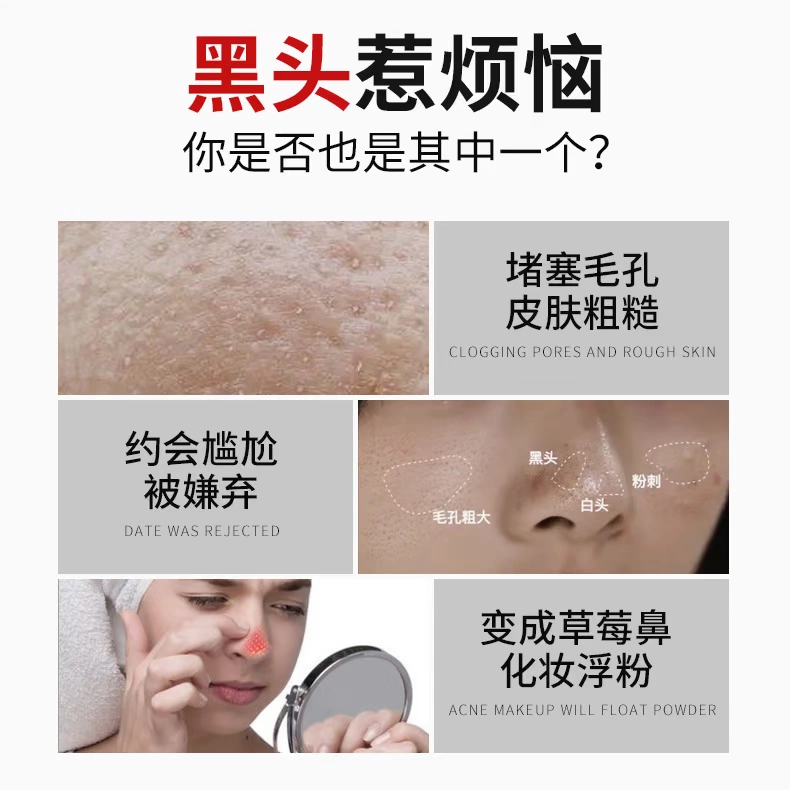 Lulan Gina Bamboo Char than Blackhead Mask Cleansing Pore Acne Mud Mask Kem mũi Nas Men - Mặt nạ mặt nạ ngủ laneige 70ml