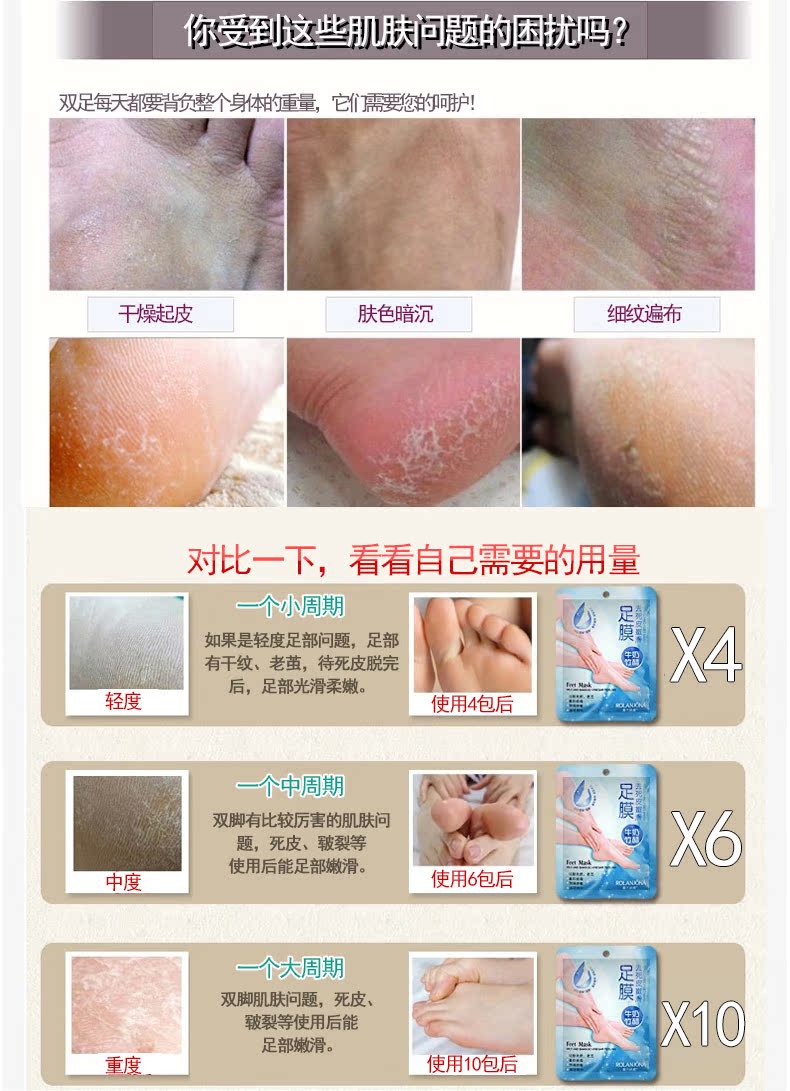 Lulan Gina Sữa giấm tre 7 túi Mặt nạ chân sừng Có tác dụng tẩy tế bào chết cho Lào mặt nạ ủ chân lột da chết