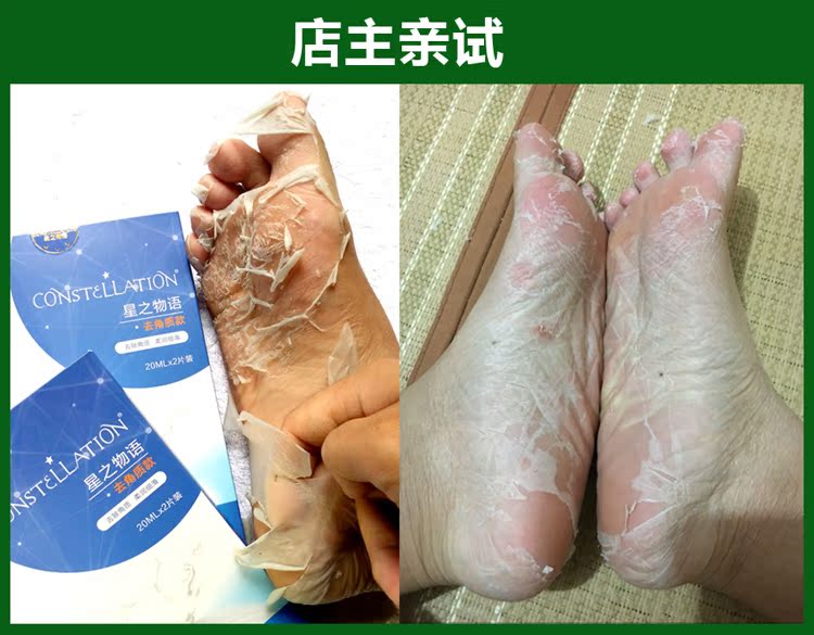 Mua 2 tặng 3 mặt nạ cho da chết, già, mềm, gót chân, khô nứt, chăm sóc chân, chân, lột, màng chân kem trị nứt gót chân hàn quốc