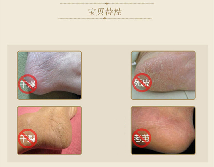 Junzhu nứt tất chân nứt chân chống nứt gót chân nứt nứt tất tất nam giá tốt