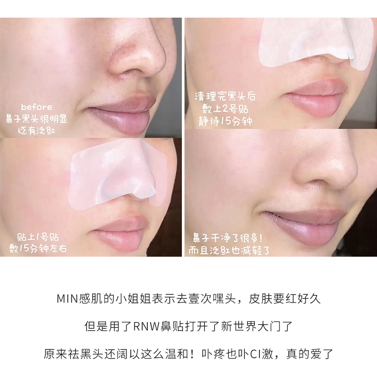 Miếng dán mũi Meng Dayu rnw làm sạch mụn đầu đen và mụn cám se khít lỗ chân lông thu nhỏ lỗ chân lông dịu nhẹ cho bộ mũi lợn xuất khẩu mặt nạ ngủ innisfree trà xanh