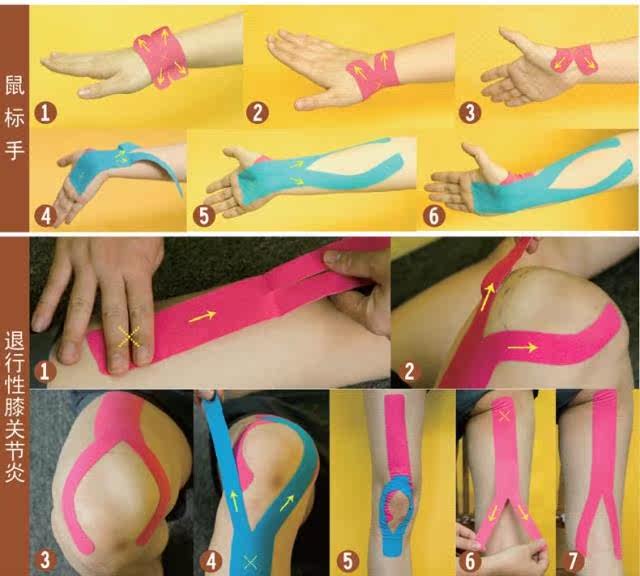 Protection sport - Ref 585328 Image 20