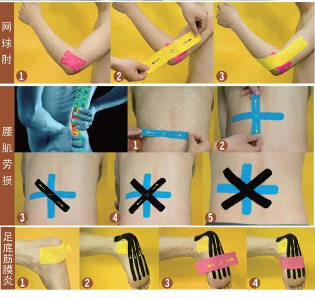 Protection sport - Ref 585328 Image 21