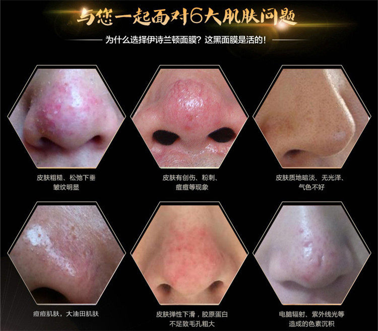 Подробная информация о бамбуковых углях на носовых мембранах_04