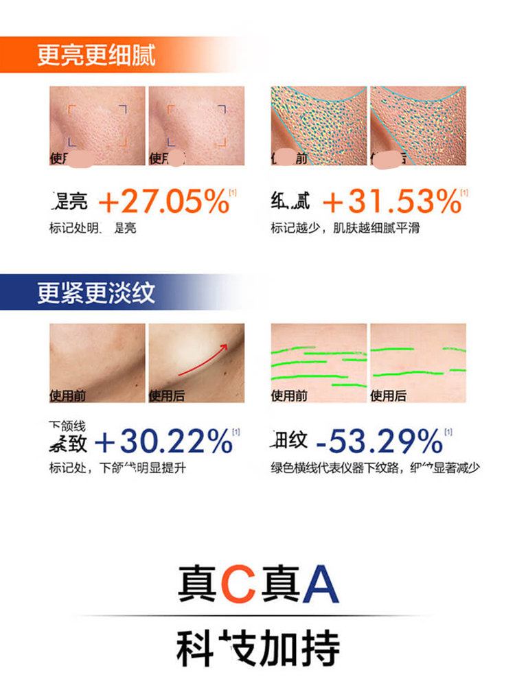 【香港直郵】 法國 巴黎歐萊雅 早C晚A雙抗精華套裝 15ml+15ml 抗氧抗糖 修護抗老 提亮膚色 改善暗沉 日夜分時護理