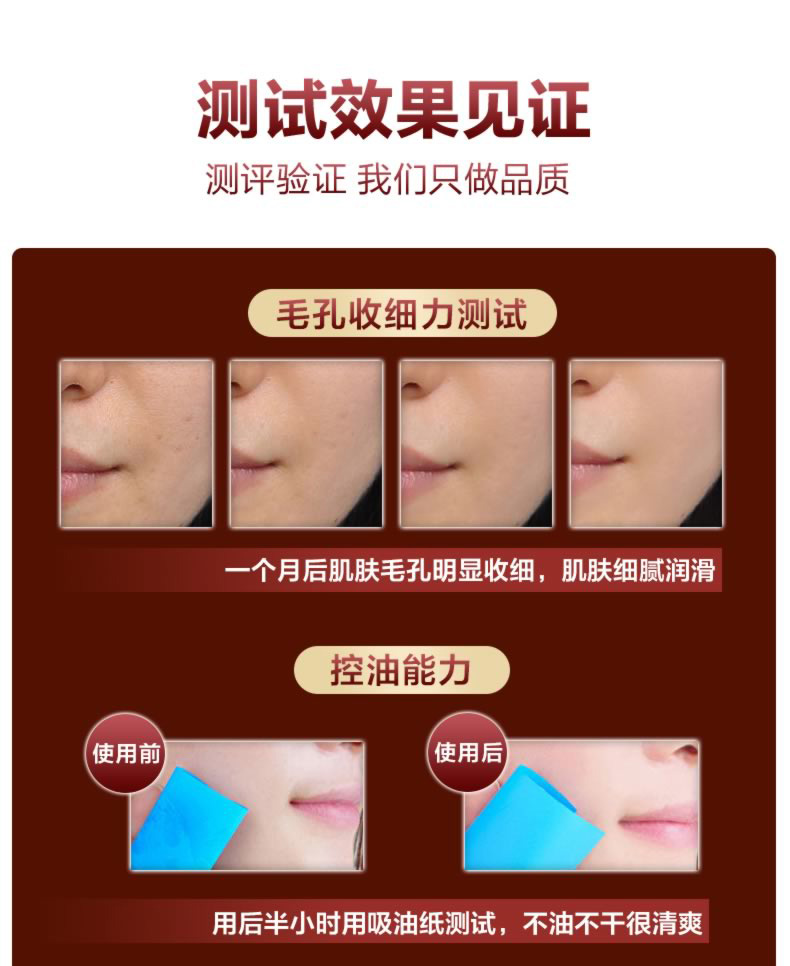 Fanxi lỗ chân lông thu nhỏ tinh chất se khít lỗ chân lông lớn sửa chữa mụn đầu đen để mụn đầu ahc vàng
