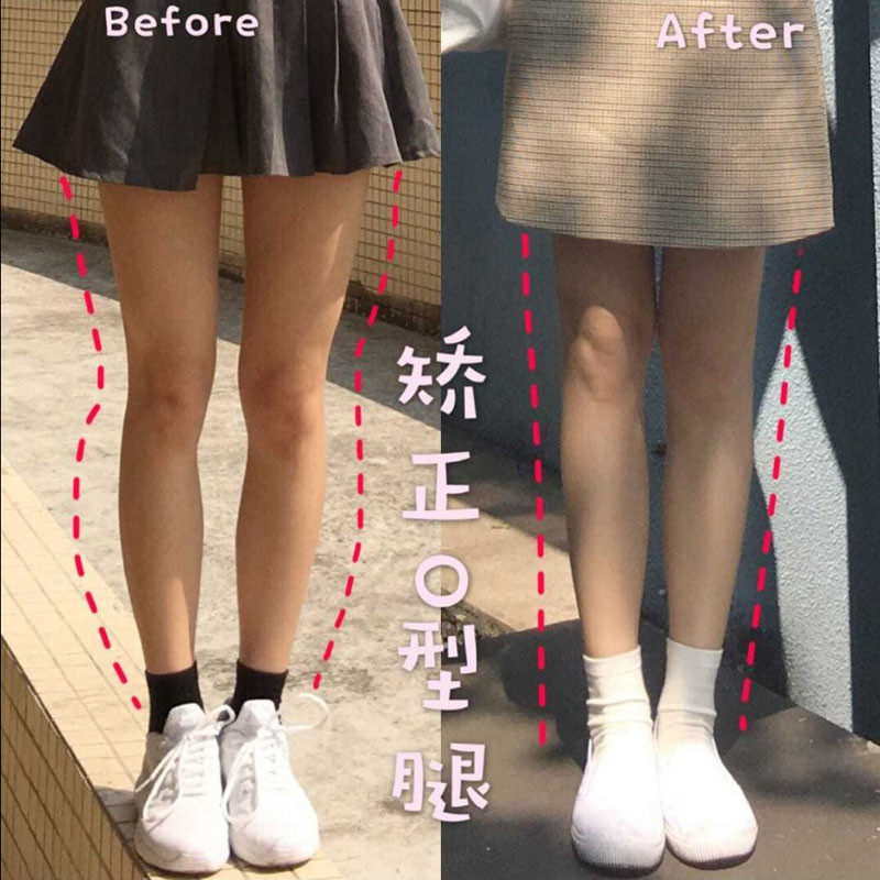 Adult children O-type leg straightening insole heel inner valgus 8-word X type shoe heel inner turning side mill insole