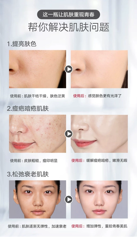 Xuezhi Ling Fullerene Facial Massage Cream Deep Cleansing Pore Face Cream Beauty Salon Chuyên dụng Độ đục kem massage mặt vitamin e