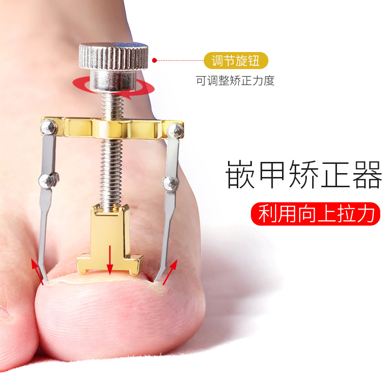 Positive nail patch Trench orthodontic foot toenails special pedicure correction of nail long meat rilala roll-in-the-nail silverware
