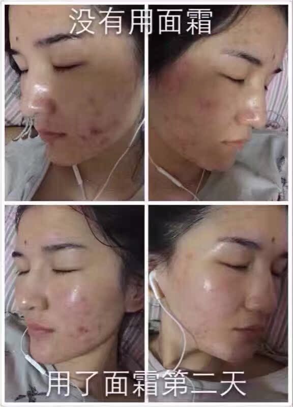 [] mặt nạ dưỡng trắng
