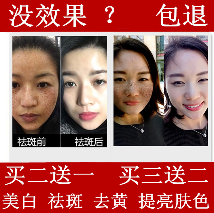 瑞士cc精油茜茜焕颜祛斑精油 专柜正品美白淡斑去黄 电视同款吉米