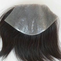 Customized forehead replacement film male head top biological scalp biofilm real hair Mediterranean hair Baldness bald to scalp