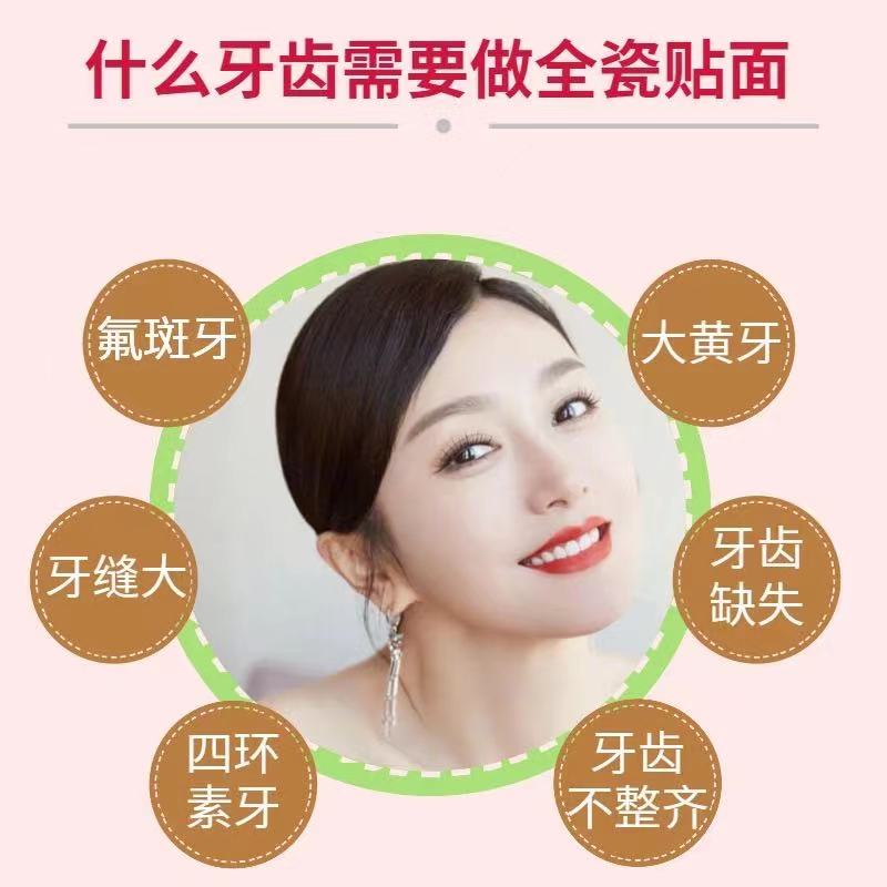 揭开义获嘉全瓷贴面的美齿奥秘