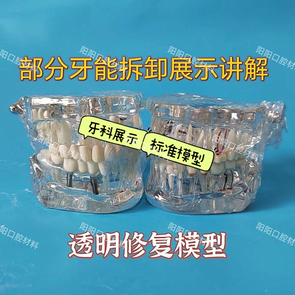 牙科口腔科病理修复模型可拆卸医患沟通假牙模型摆件口腔展示模具