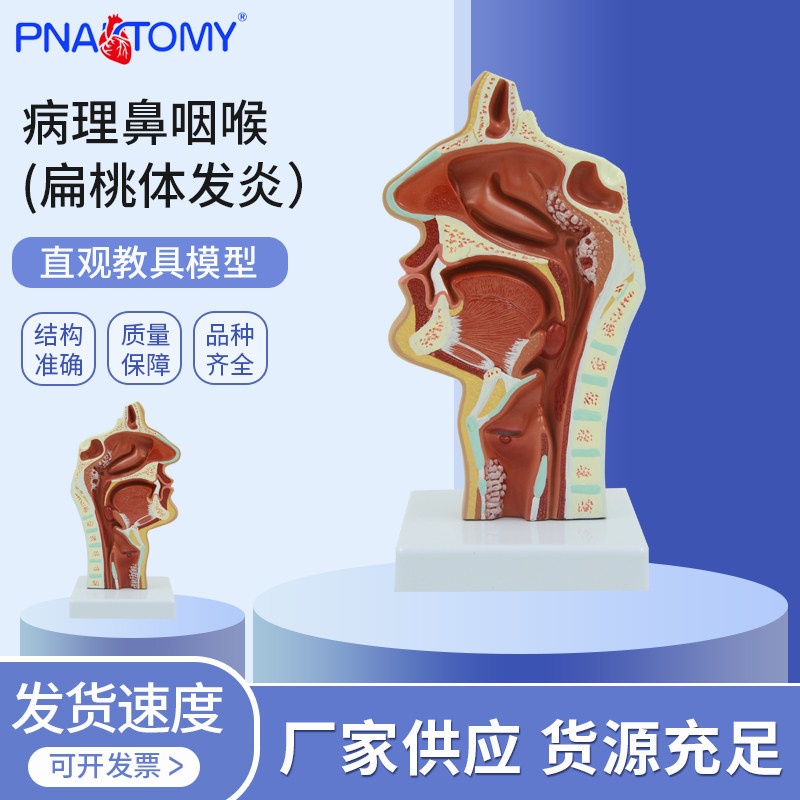 医学教学病理鼻咽喉扁桃体发炎解剖模型扁桃体淋巴咽喉病理五官科