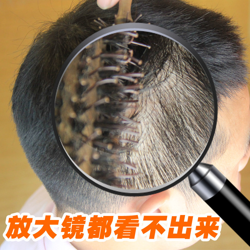 Dawning door-to-door replacement hair weaving male real hair on the top of the head without trace hairline increase biological scalp custom wig