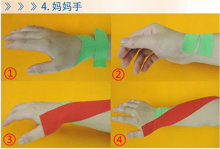 Protection sport - Ref 583770 Image 21