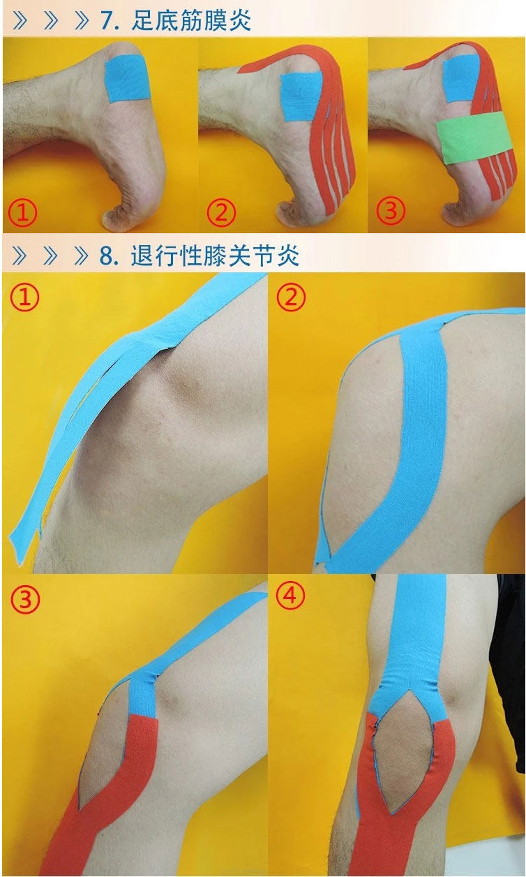 Protection sport - Ref 583770 Image 23